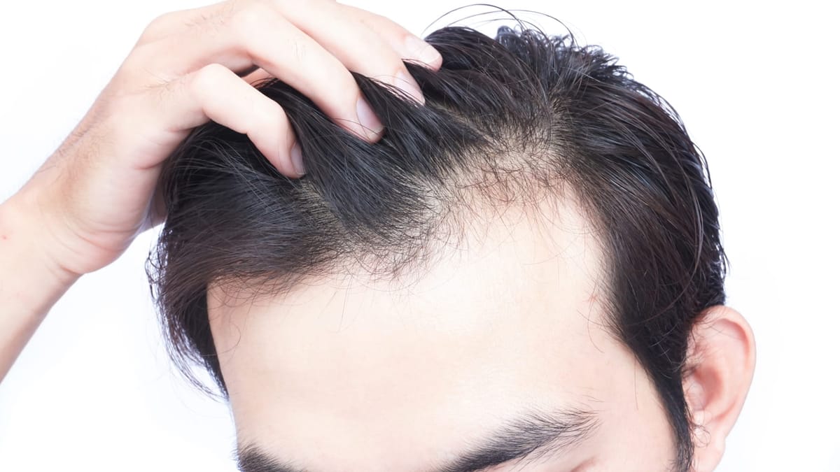 Let's Combat Hair Loss